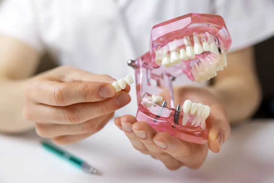 Dental crowns & bridges Dental crowns & bridges